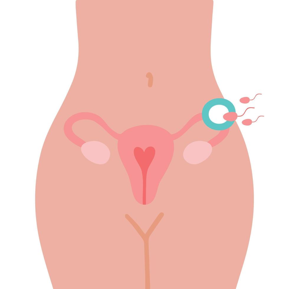 Fertilization icon. Uterus, sperm, insemination. Fertilization in the fallopian tube. Embryology. vector