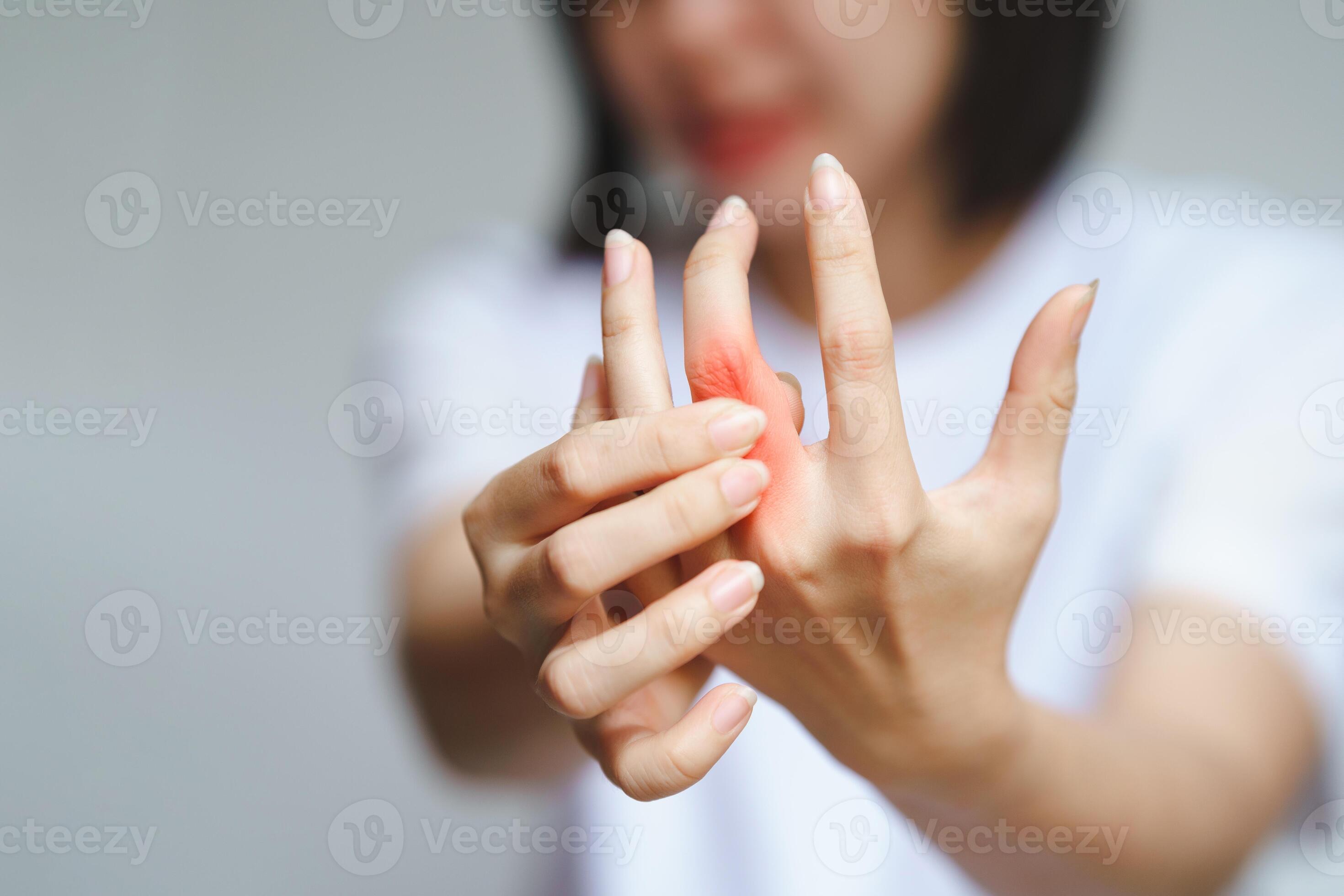 Woman has finger joint pain due to rheumatoid arthritis. Health care
