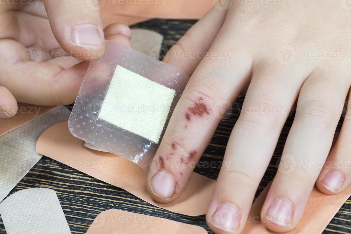 one damaged finger photo