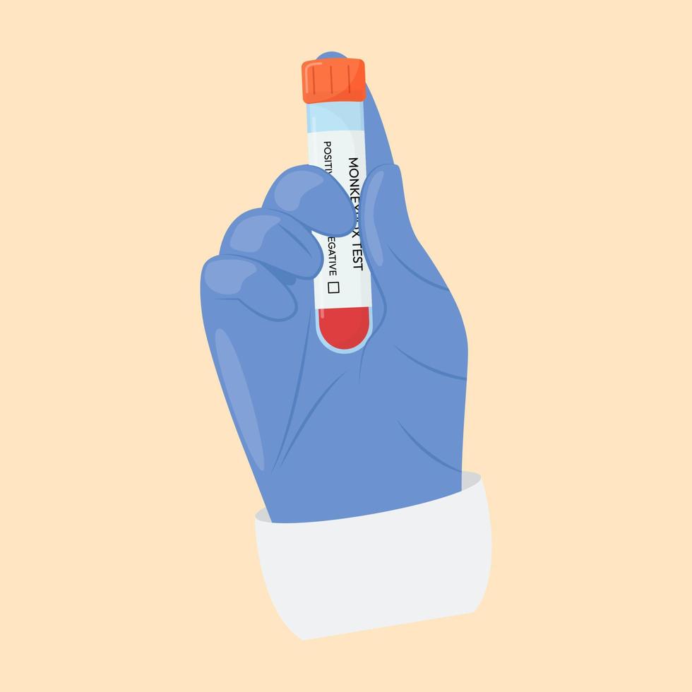la mano de un médico con guante protector sostiene un tubo de ensayo. prueba del virus de la viruela del simio. prueba positiva o negativa. sistemas de prueba. vector