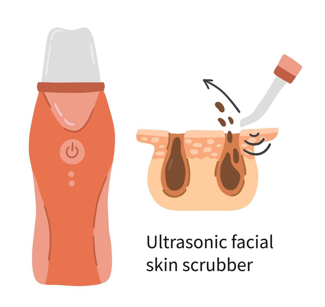 Peeling cleansing ultrasonic facial skin scrubber vector illustration with layers of dermis and pores. Electronic device for skin care in a flat cartoon style. Removal spatula for blackhead and cells