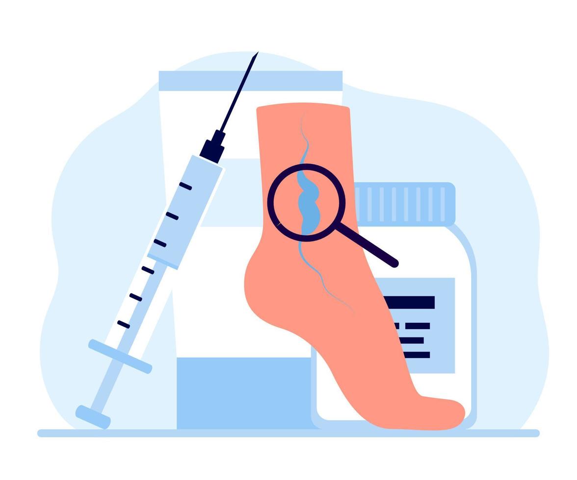 Varicose and vein thrombosis, treatment leg. Drugs and medical instruments medication foot with diseased veins. Examination blood vessels and veins, health care. Vector Illustration