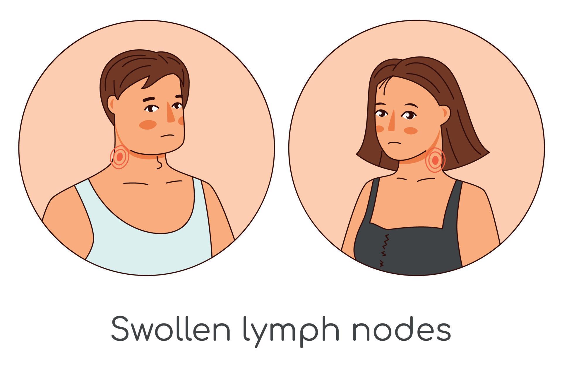 Swollen lymph nodes man and woman icons. Flu virus cold Cartoon medical