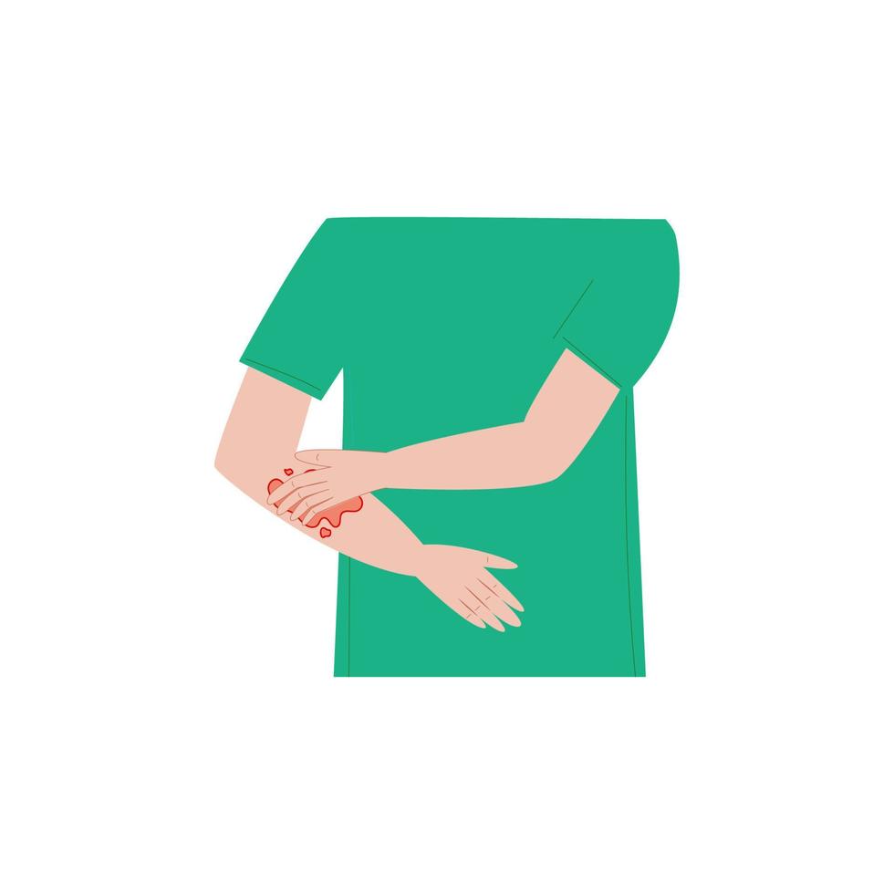 Young man or women scratching arm. Guy suffering from strong allergy skin itchy symptom in flat design. Red rash skin irritation. Vector illustration.