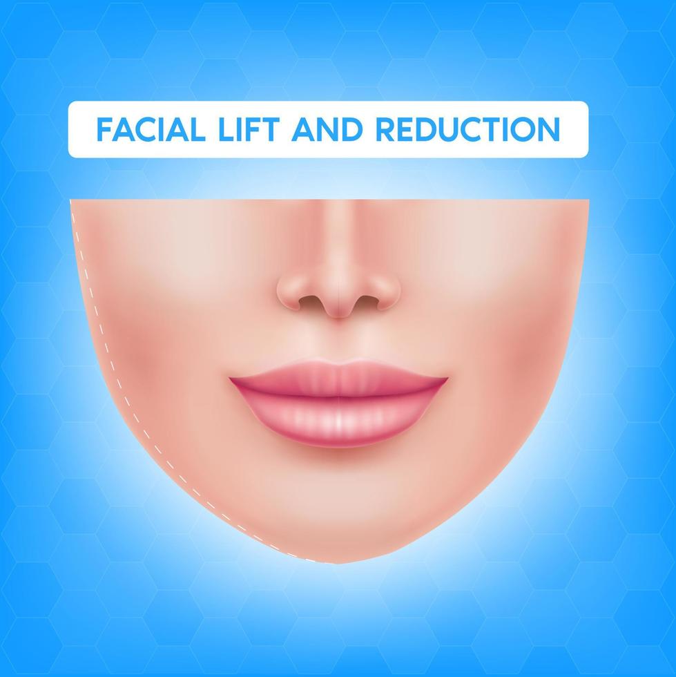 White female face before after plastic surgery jaw reduction and botox injections facial lift and reduction. For advertising of plastic surgery. Medical and beauty concept. Vector EPS10 illustration.