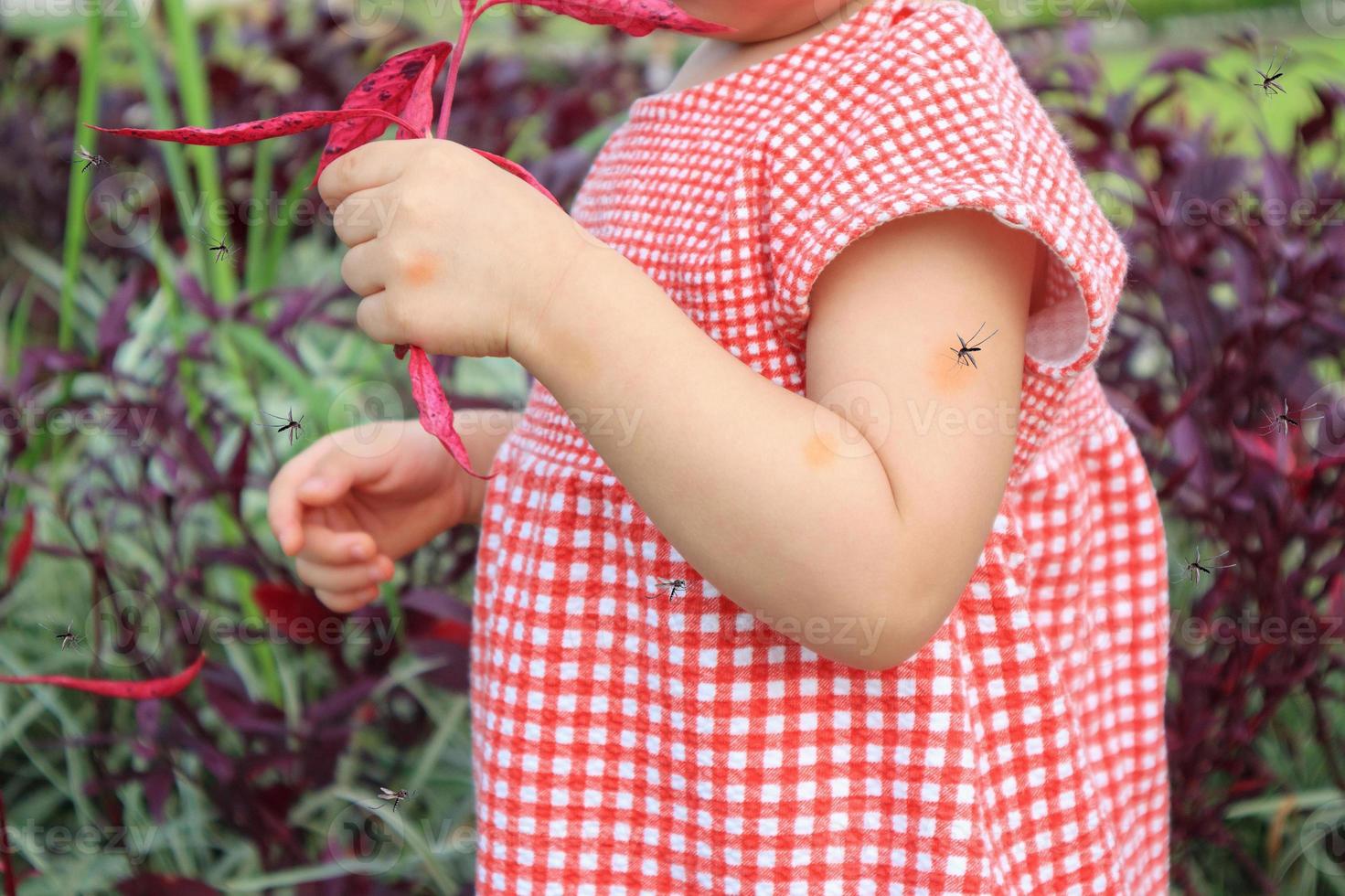 linda niña asiática tiene erupción cutánea y alergia por picadura de mosquito y chupa sangre mientras juega al aire libre foto