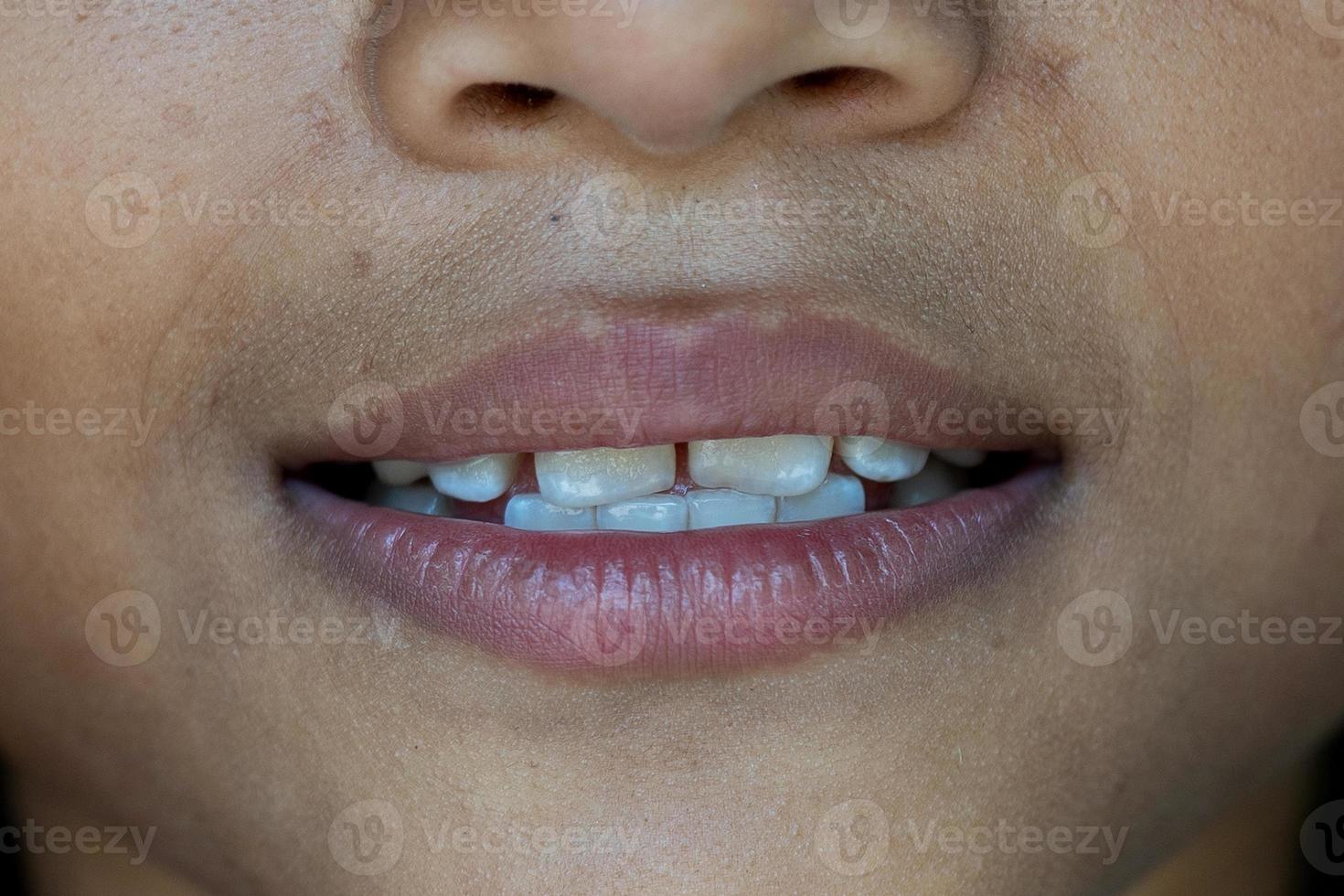 baby smile close. white teeth of a child isolated on a white background photo