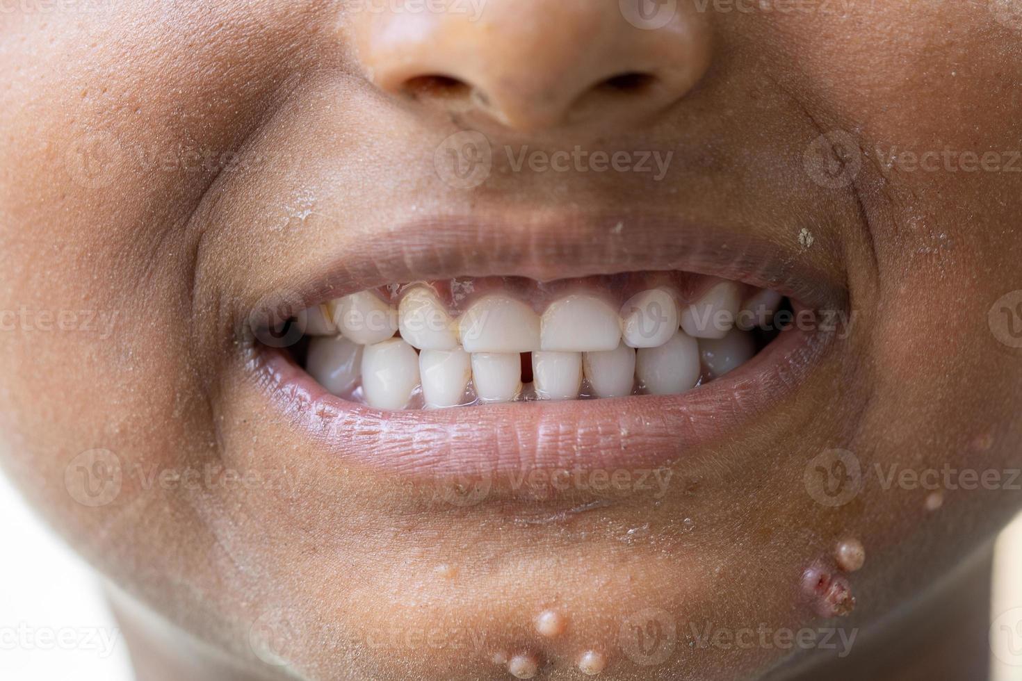 baby smile close. white teeth of a child isolated on a white background photo