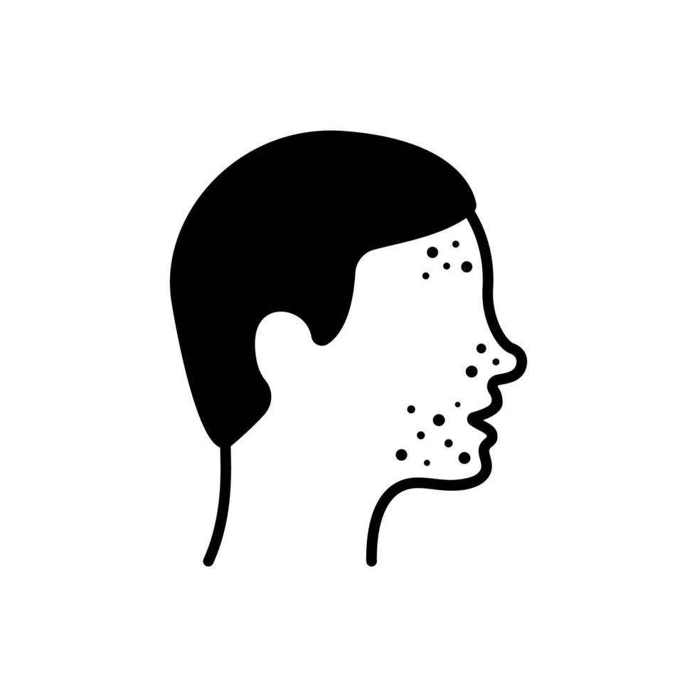 Boy with Pimples on Face Silhouette Icon. Man with Blackhead, Acne, Rash Pictogram. Dermatologic Problem, Allergy, Inflammation Skin Black Icon. Isolated Vector Illustration.