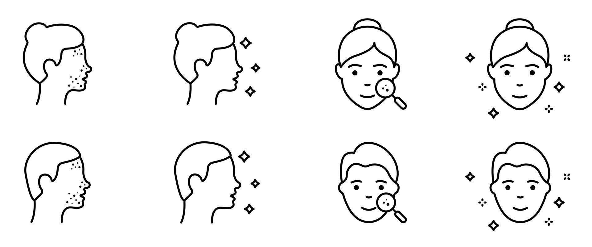 Woman and Man Faces Outline Icon. Pimples on Face, Blackhead, Acne, Rash Line Icon Set. Girl and Boy with Beauty Face. Dermatologic Problem, Allergy, Inflammation Skin. Vector Illustration.