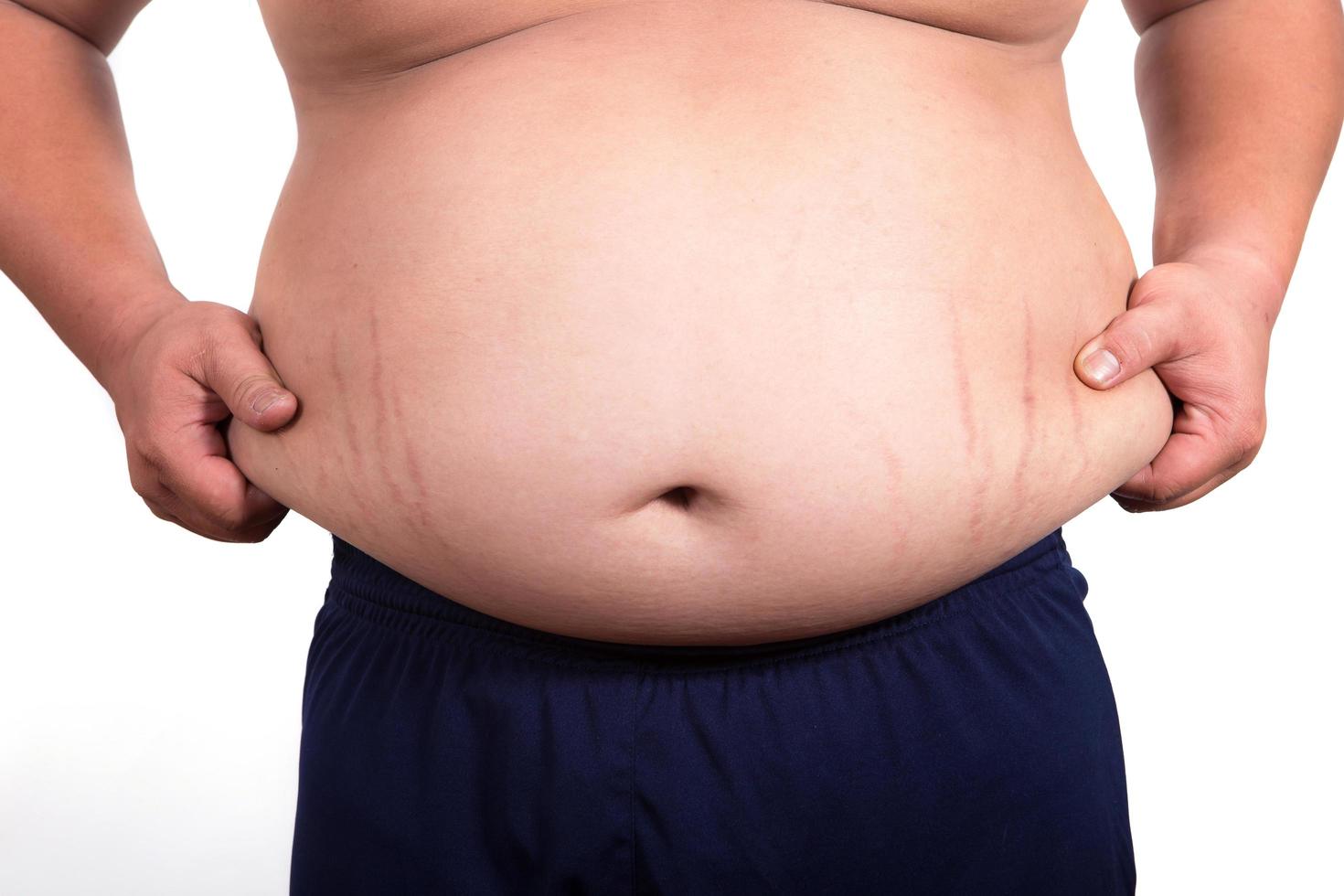 Fat man with a big belly. Diet 9587734 Stock Photo at Vecteezy