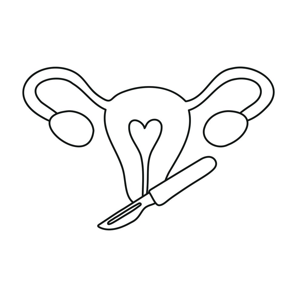 cirugía ginecológica, problema con el sistema reproductivo. ginecología. útero, ovarios y bisturí. vector