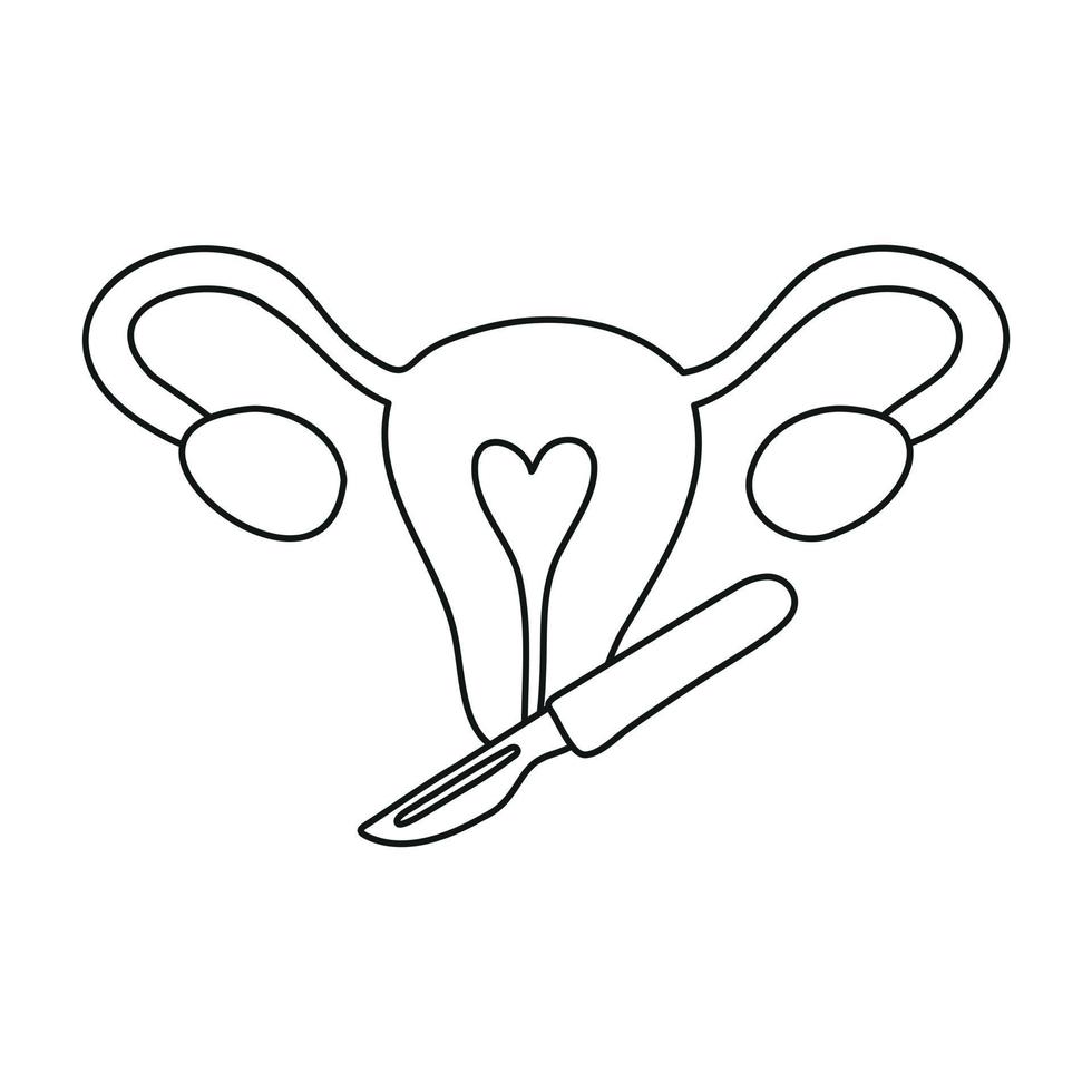 Gynecological surgery, problem with reproductive system. Gynecology. Uterine, ovaries and scalpel. vector
