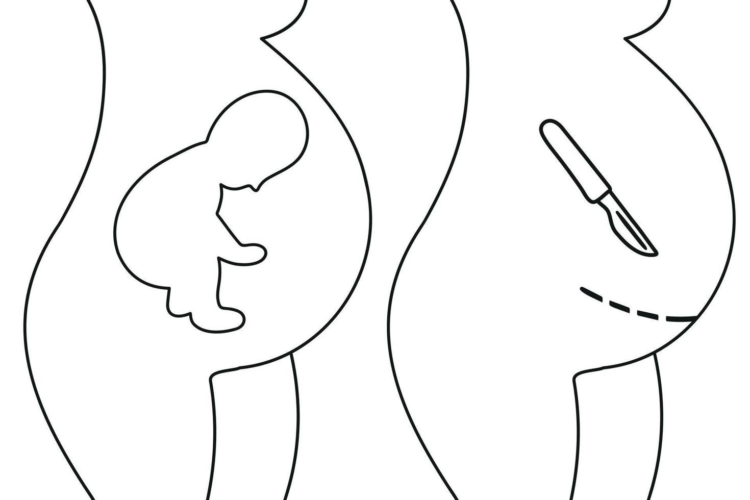 Fertilization thin line icon. Uterus, sperm, insemination. Fertilization in the fallopian tube. Embryology. vector