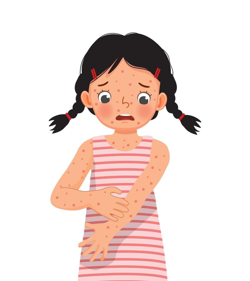 cute little girl scratching her itchy suffering from measles rash allergy skin vector