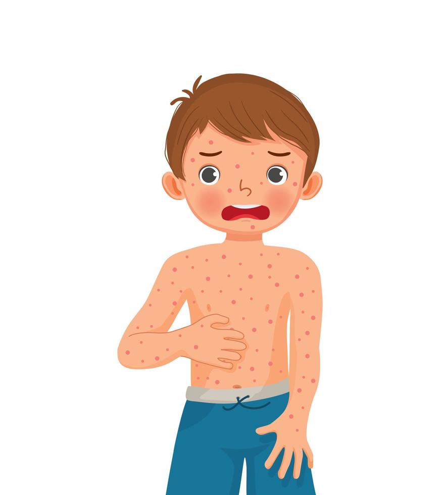 cute little boy scratching his itchy suffering from measles rash allergy skin vector