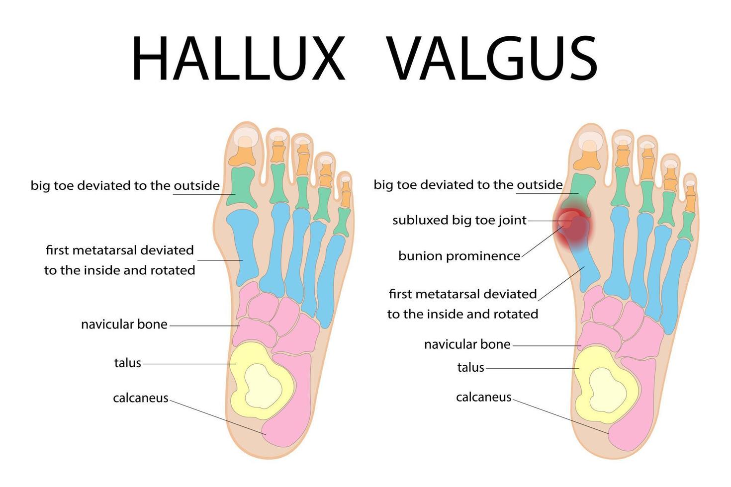 The structure of the human foot. Colorful symbols. Vector illustration.