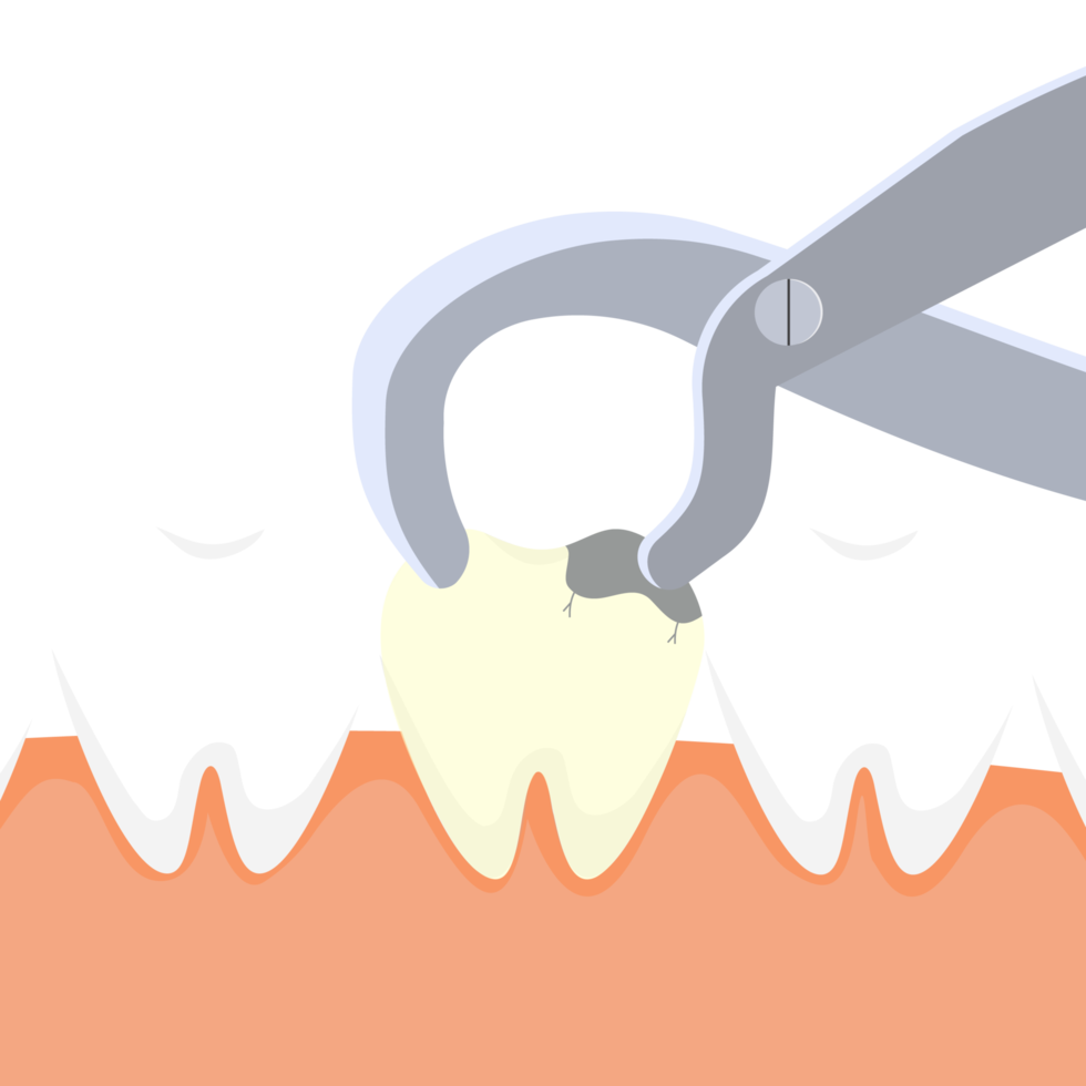 tandläkare som drar ut en död tand med utrustning. tandvårdsverksamhet med en tandläkarnyckel och en död tandvektor. död tand extraktion illustration. koncept för tandborttagning. png