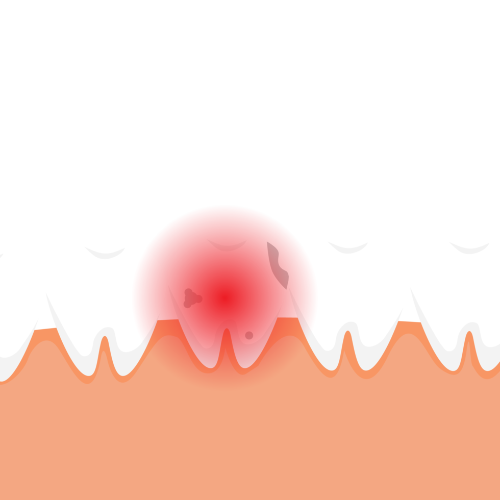 dode tand doet pijn en geeft een rood pijnsignaalconcept. een slechte tand met gaatjes en een rood gevarensignaal. tandheelkundige infographic elementen vector met een dode tand. stomatologie zorg voor tanden. png