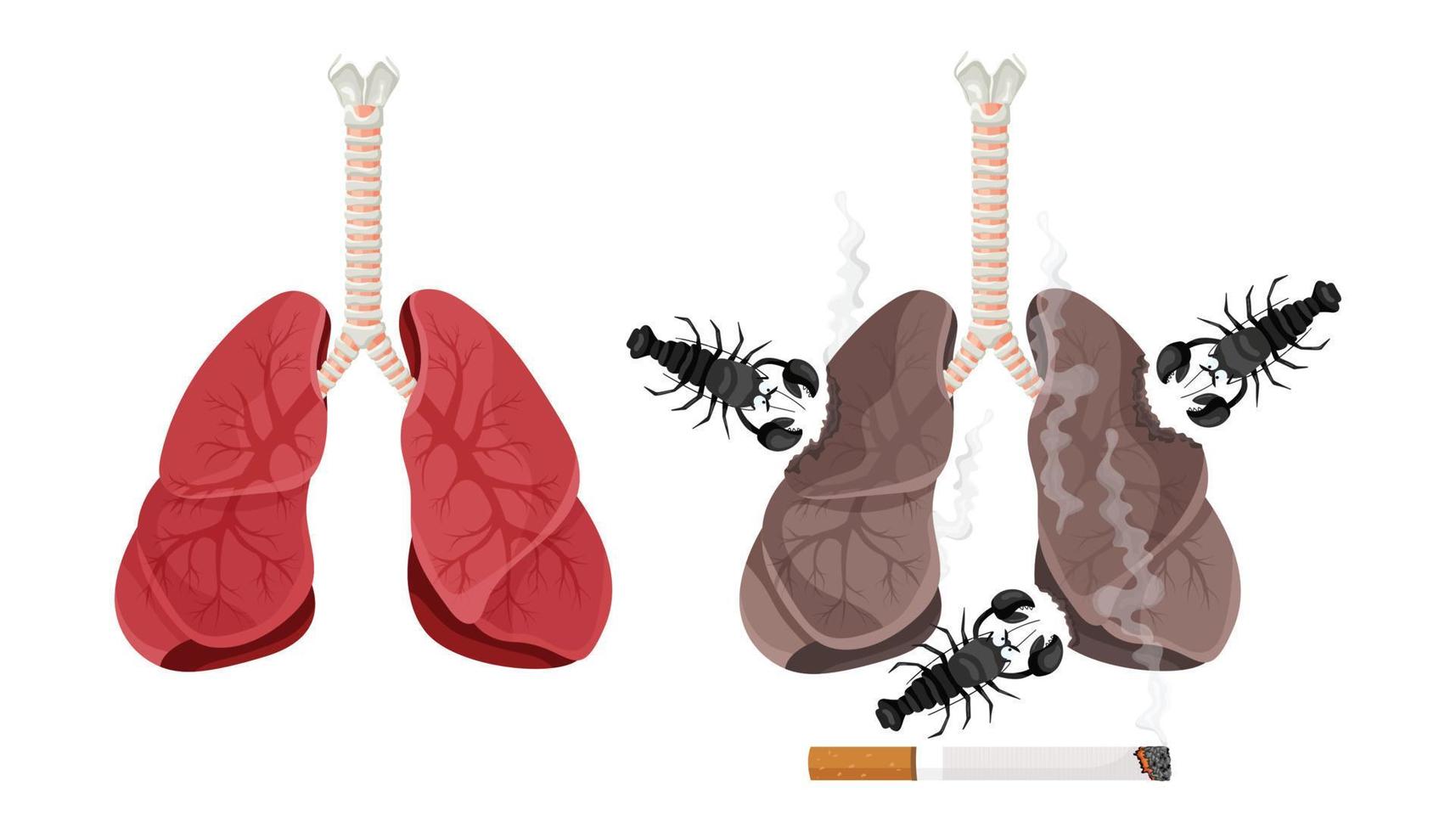 ilustración de fumador de pulmón, enfermedad de cáncer de pulmón. el concepto de dejar de fumar. ilustración vectorial vector