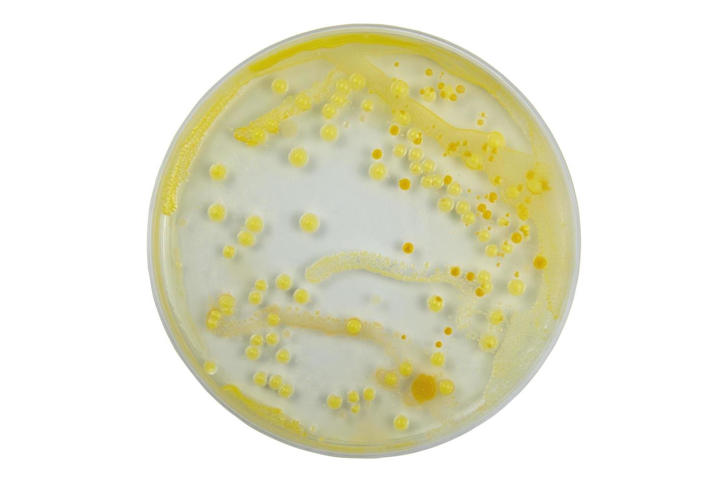 Top view of petri dish and culture media with bacteria on white background with clipping, solid media, nutrient agar, Test various germs, virus, Coronavirus, Corona, COVID-19, Food, Food science. photo