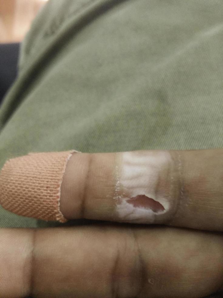 plaster on lesion finger for first aid concept photo