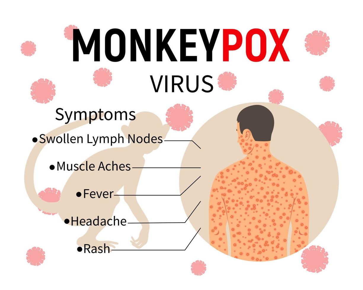 Infografía de los síntomas de la viruela del simio. pancarta con texto, una silueta de un mono y un cuerpo humano con una erupción. síntomas de la enfermedad: ganglios linfáticos inflamados, dolores musculares, fiebre, dolor de cabeza, erupción cutánea. vector. vector