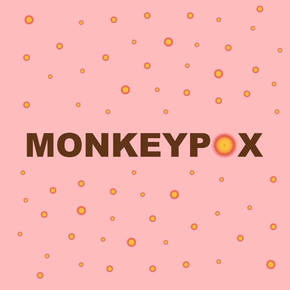 monkeypox text with smallpox spots illustration background vector