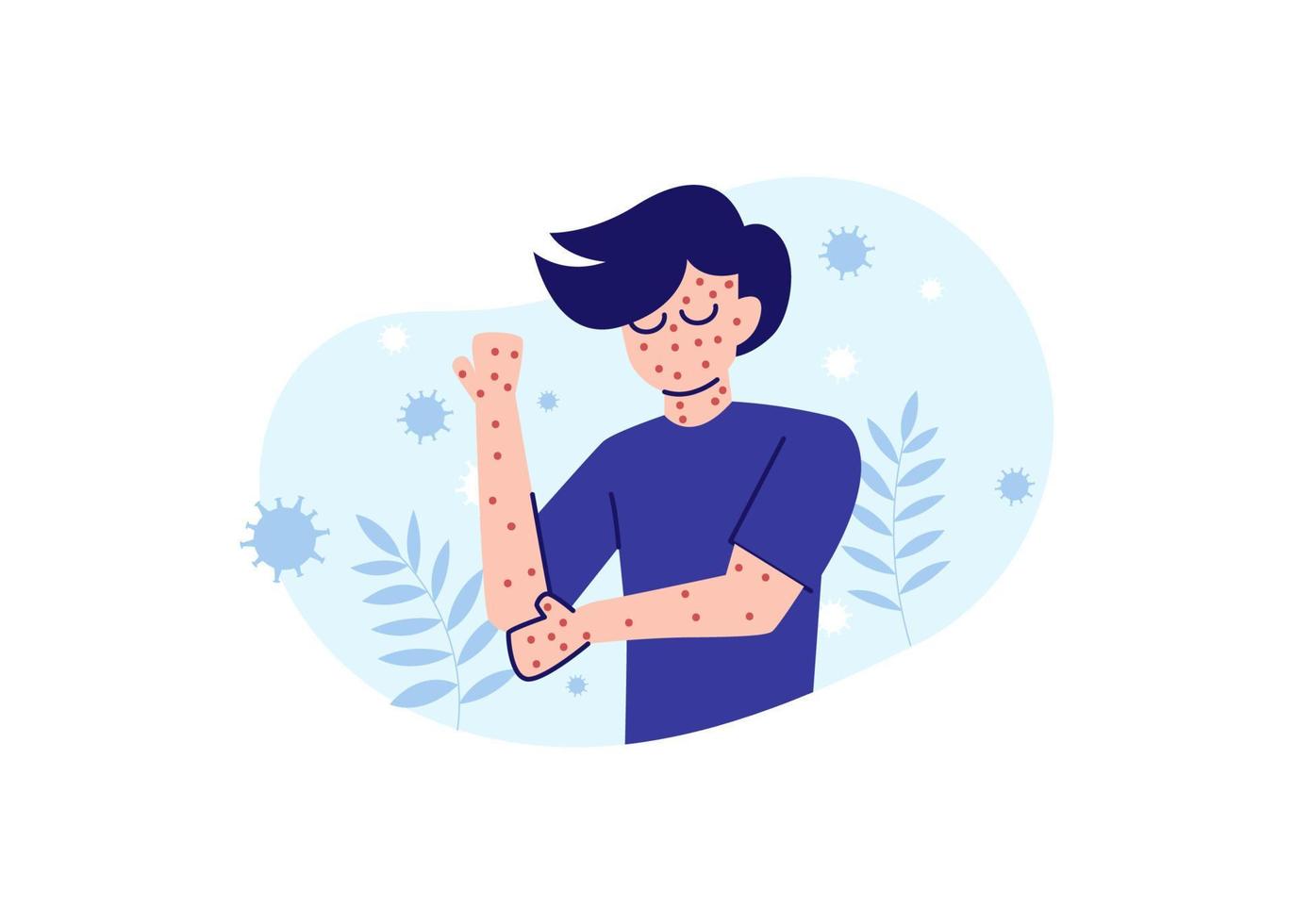 Síntomas de viruela del mono o viruela del mono vector de ilustración plana aislado. un hombre rascándose la mano debido a los síntomas de la viruela del mono.