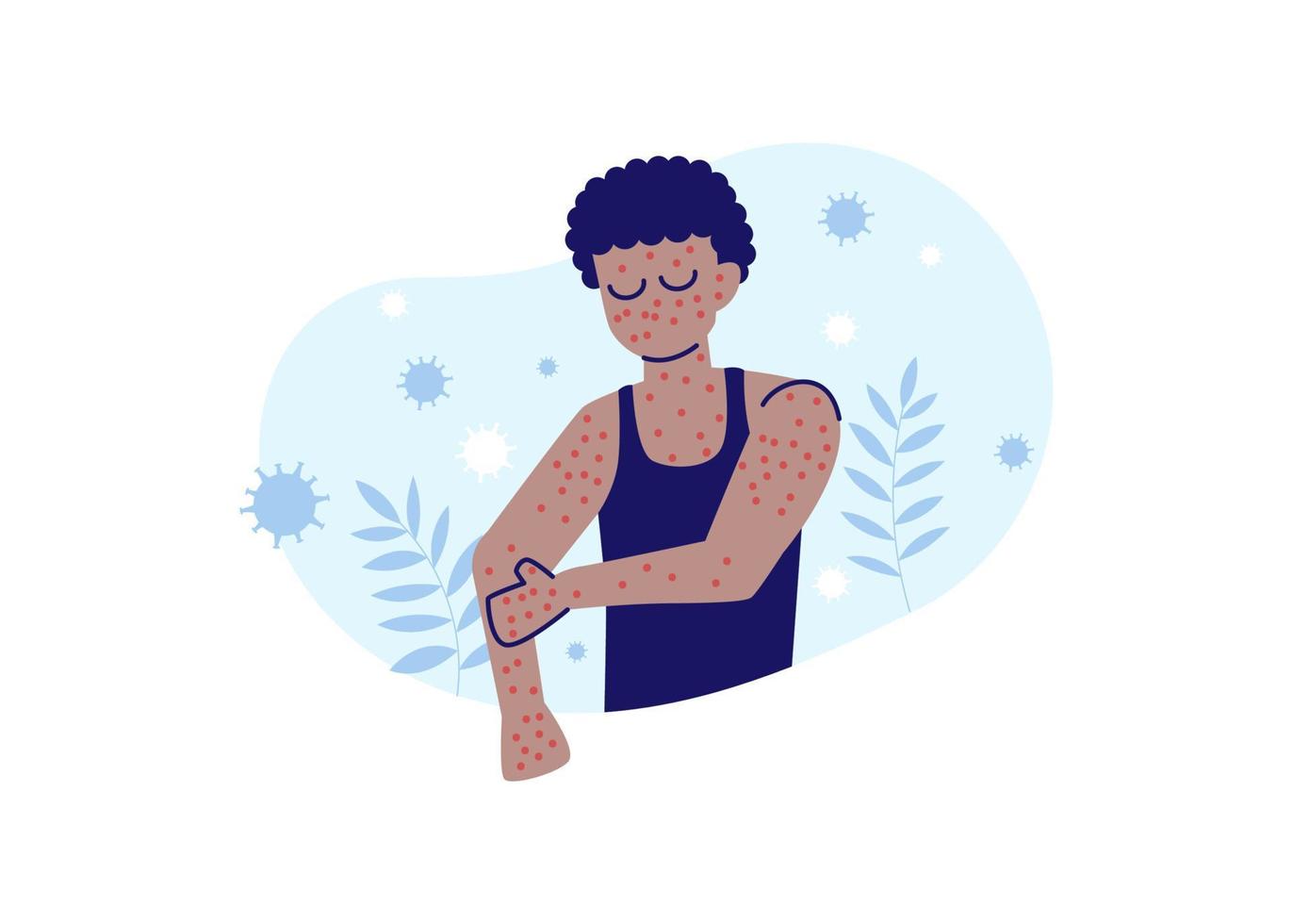 Monkeypox or Monkey Pox Symptoms Flat Illustration Vector Isolated. A man scratching his hand because of monkeypox symptoms.