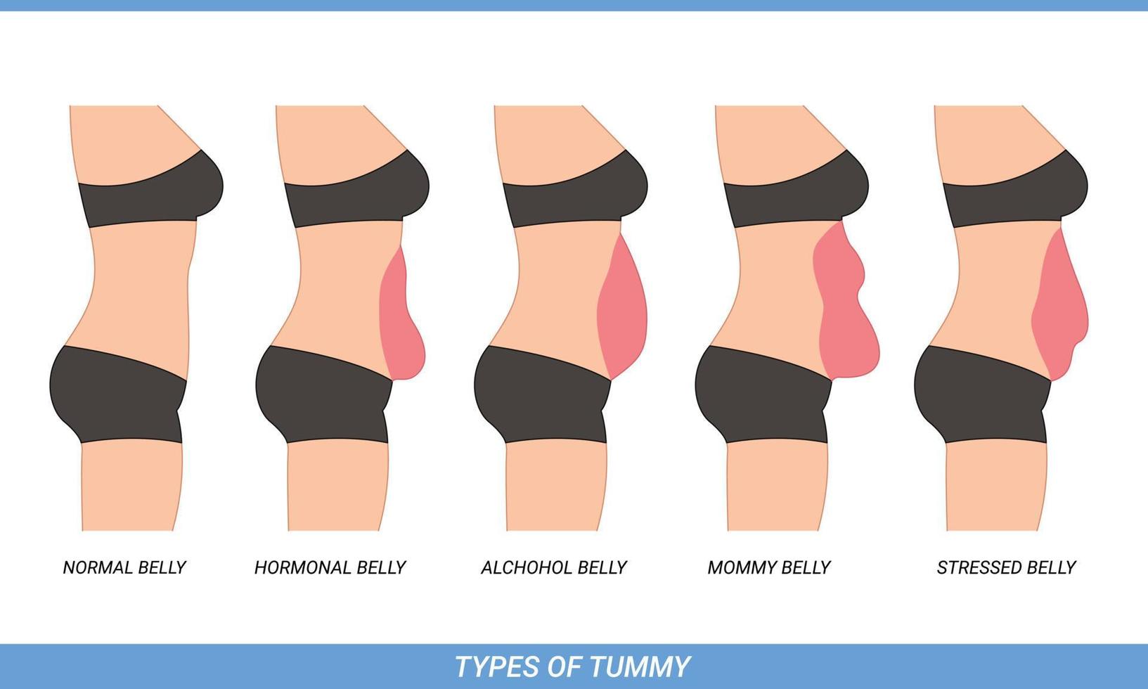 Illustration of Types Of Tummies for woman vector