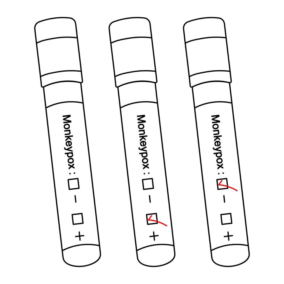 Diagnosis of blood samples for monkeypox virus. Sketch. Test tubes with patient tests. Set of vector illustrations. Three results positive, negative, unfinished.