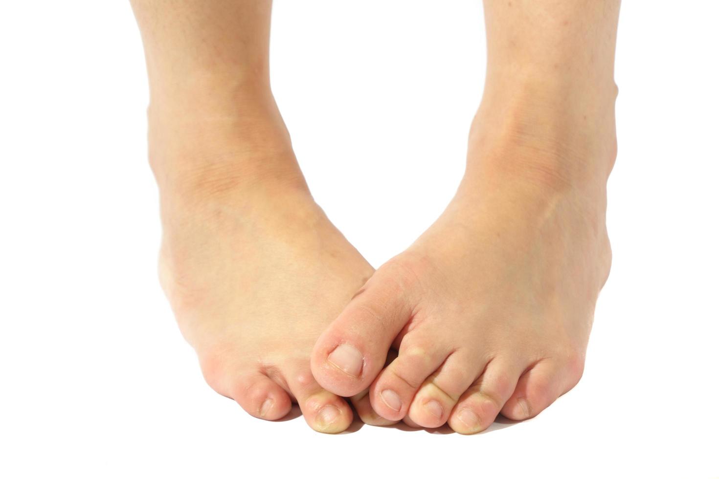 Woman's foot smelly on white background photo