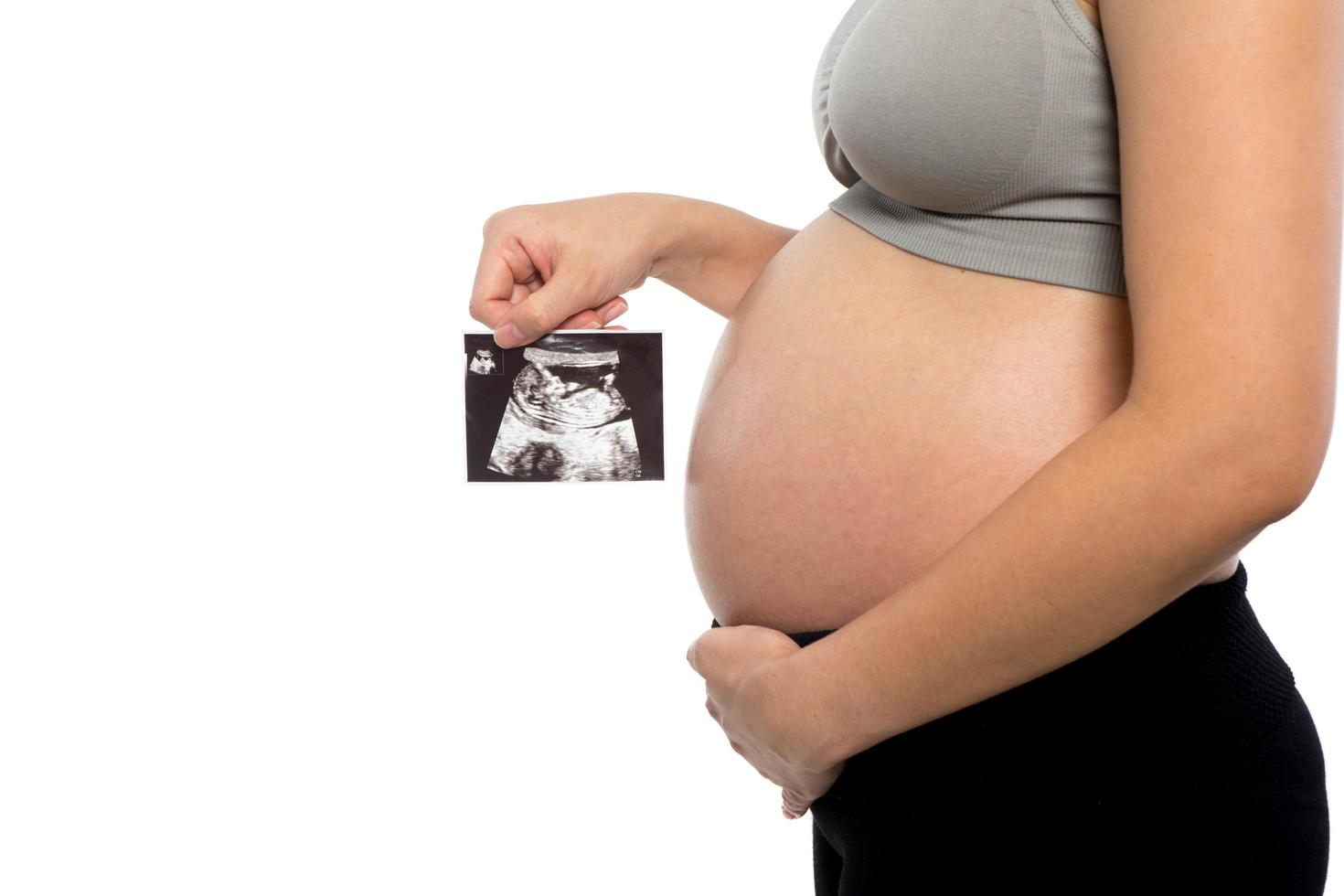 Primer plano de una mujer embarazada con imagen de ultrasonido sobre fondo blanco. foto