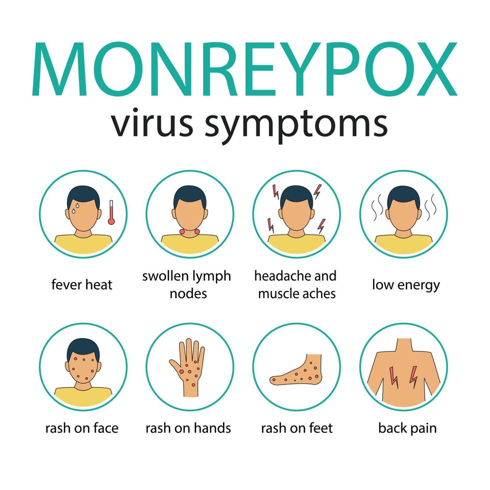 infografía detallada de los síntomas del virus de la viruela del simio vector