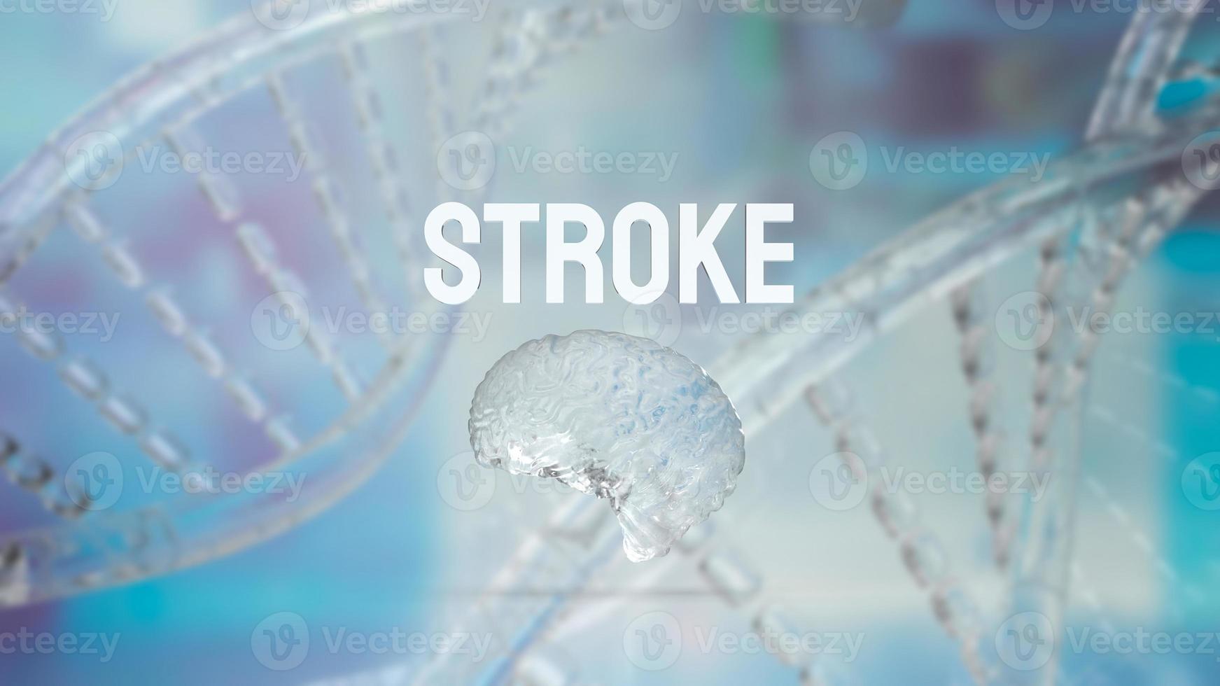 The brain and stroke word for health or sci concept 3d rendering photo