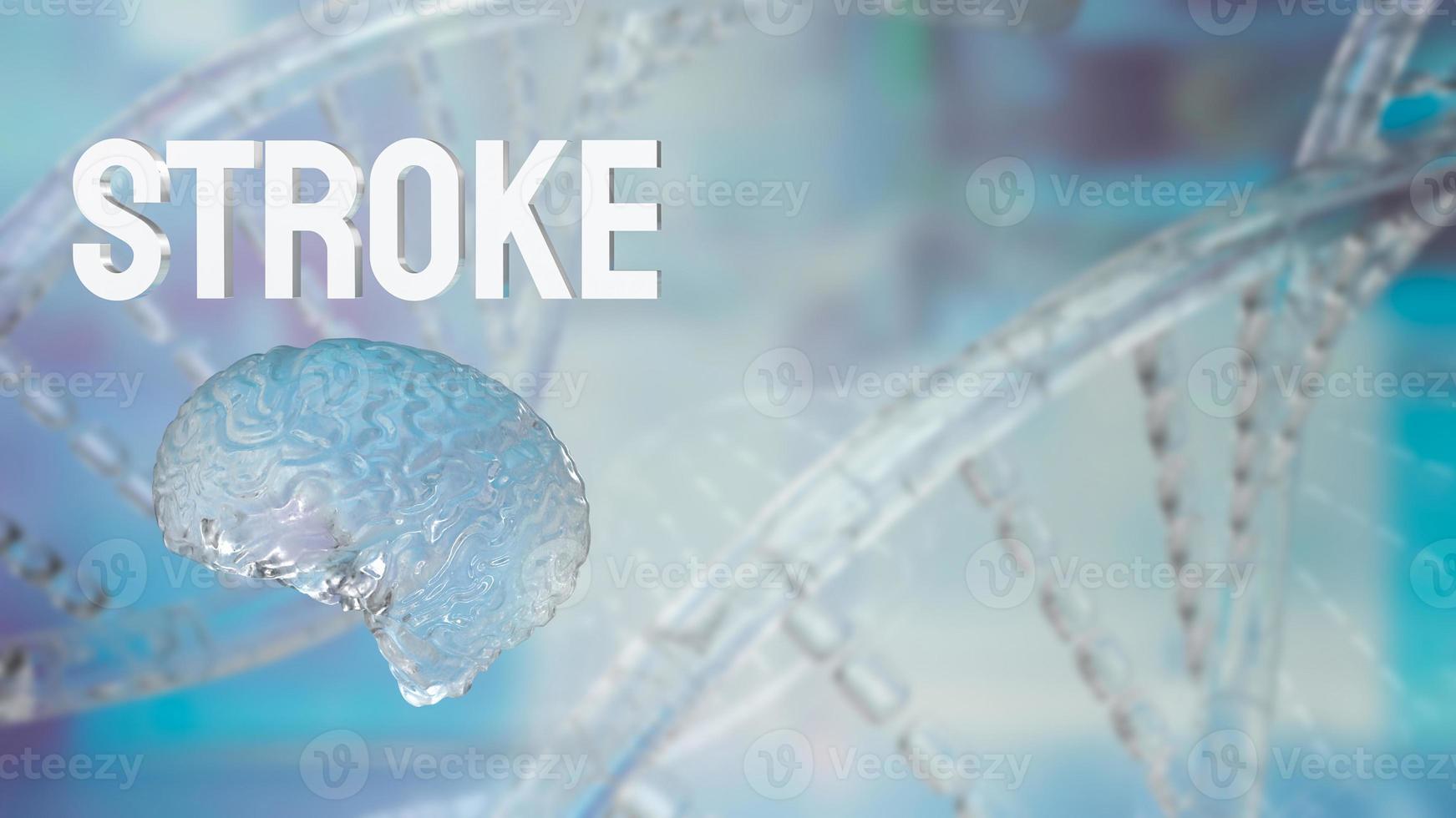 The brain and stroke word for health or sci concept 3d rendering photo