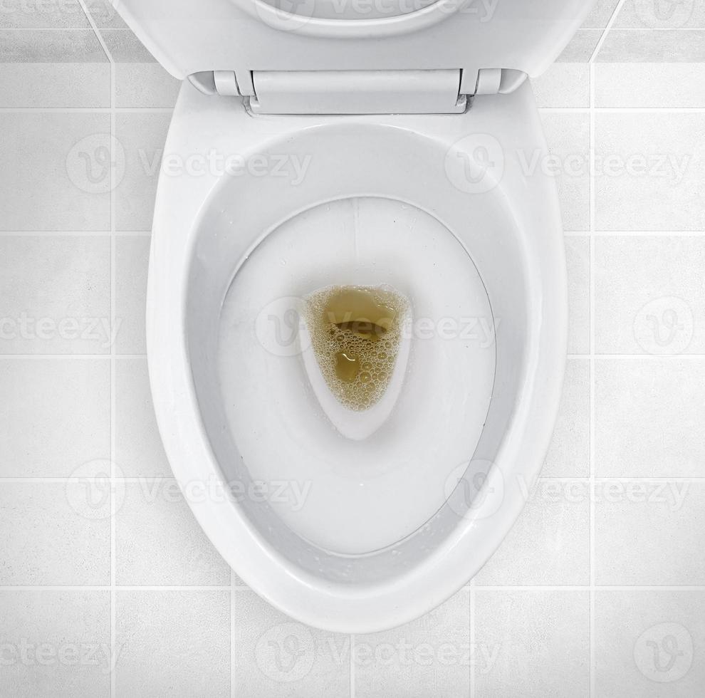 bathroom toilet with dark colored urine photo
