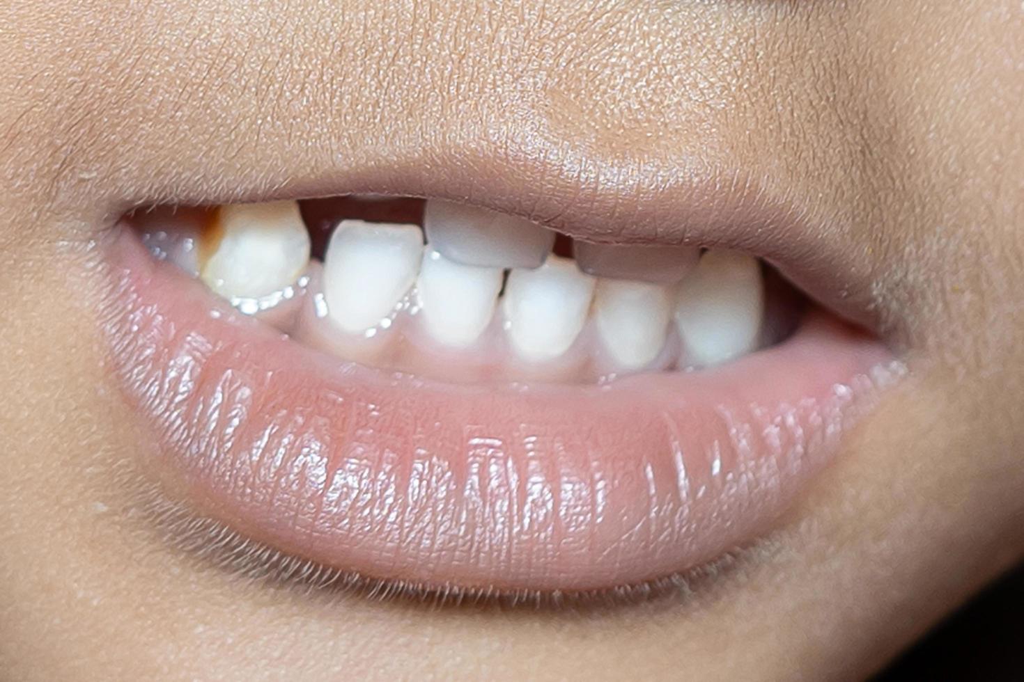 baby smile close. white teeth of a child isolated photo