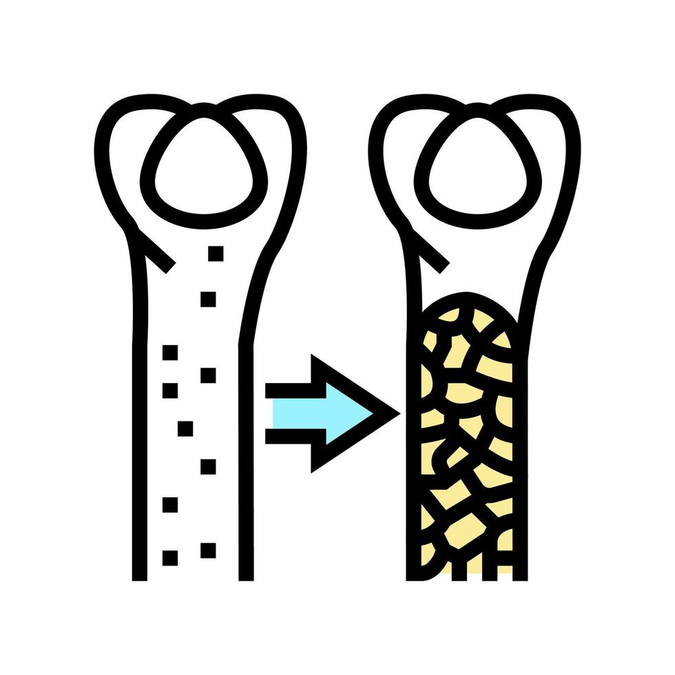 osteoporosis enfermedad ósea color icono vector ilustración
