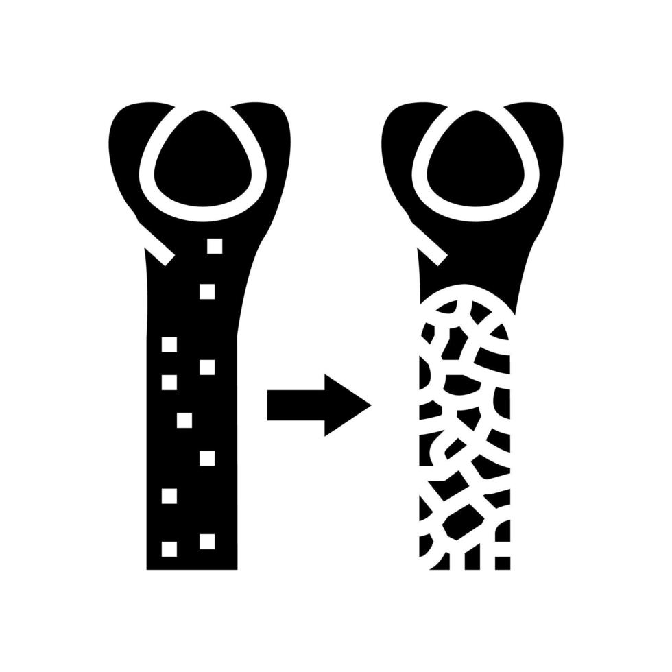 osteoporosis enfermedad ósea glifo icono vector ilustración