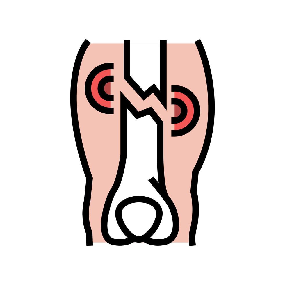 ilustración de vector de icono de color de enfermedad de fractura de extremidad cerrada