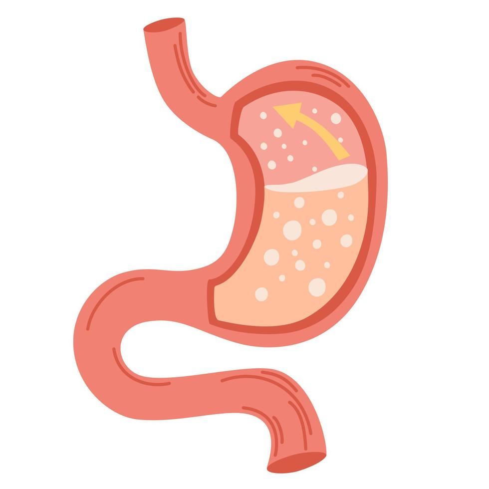 Human stomach. Gastroesophageal reflux disease concept. Unhealthy stomach concept. Heartburn, illness, discomfort, pain. Flat vector illustration isolated on white