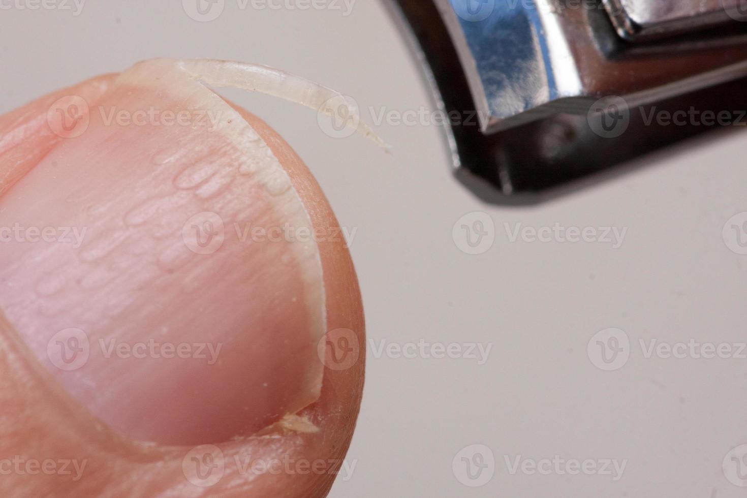 Man trimming his fingernails with a pair of nail trimmers photo