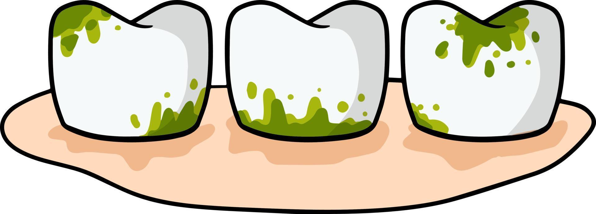 Caries and dental problems. Dentistry and sick dirty teeth with stains. Oral hygiene. Medical care. Gingivitis. The need for cleaning. Tooth decay. Cartoon illustration vector