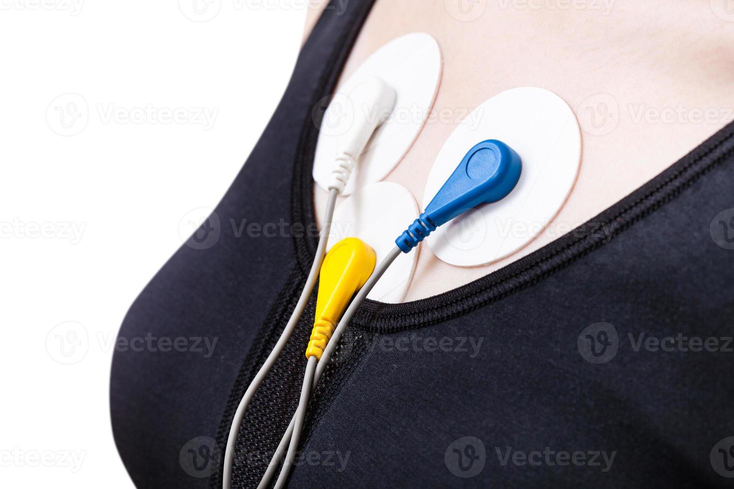 side view of electrodes of Holter monitor on chest photo
