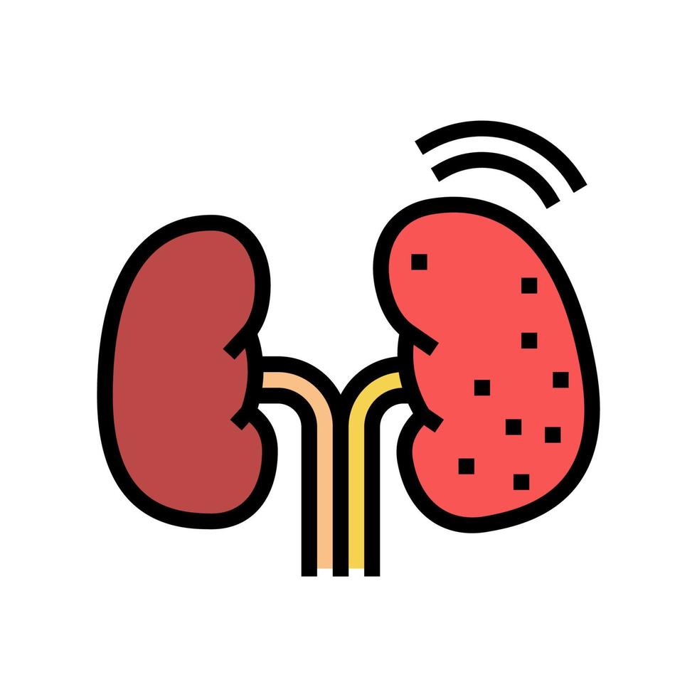 ilustración de vector de icono de color de riñón de cáncer
