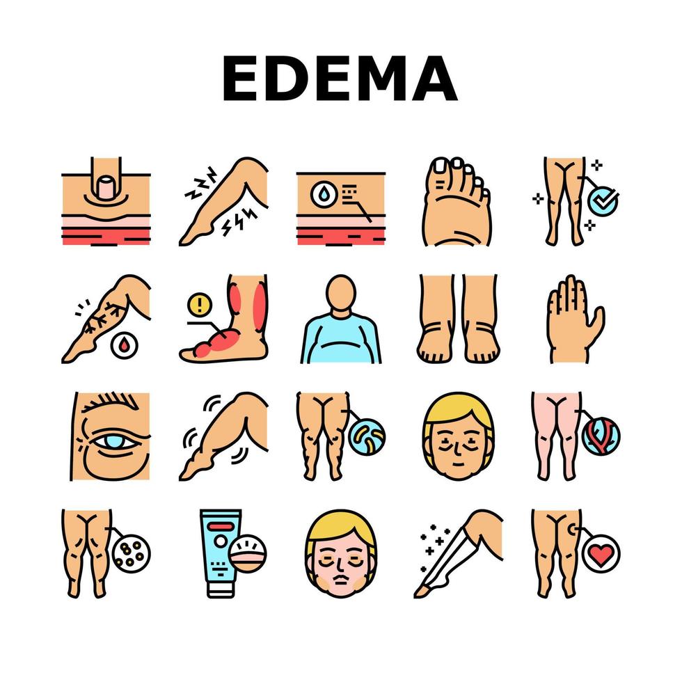 conjunto de iconos de colección de síntomas de enfermedad de edema vector