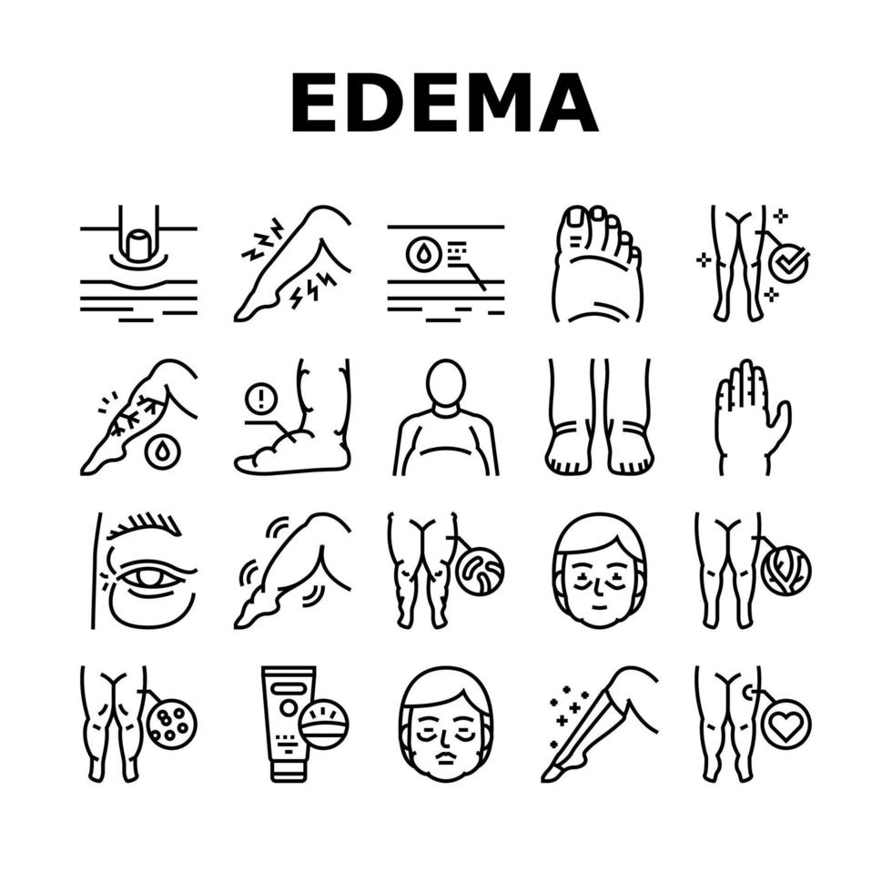 conjunto de iconos de colección de síntomas de enfermedad de edema vector