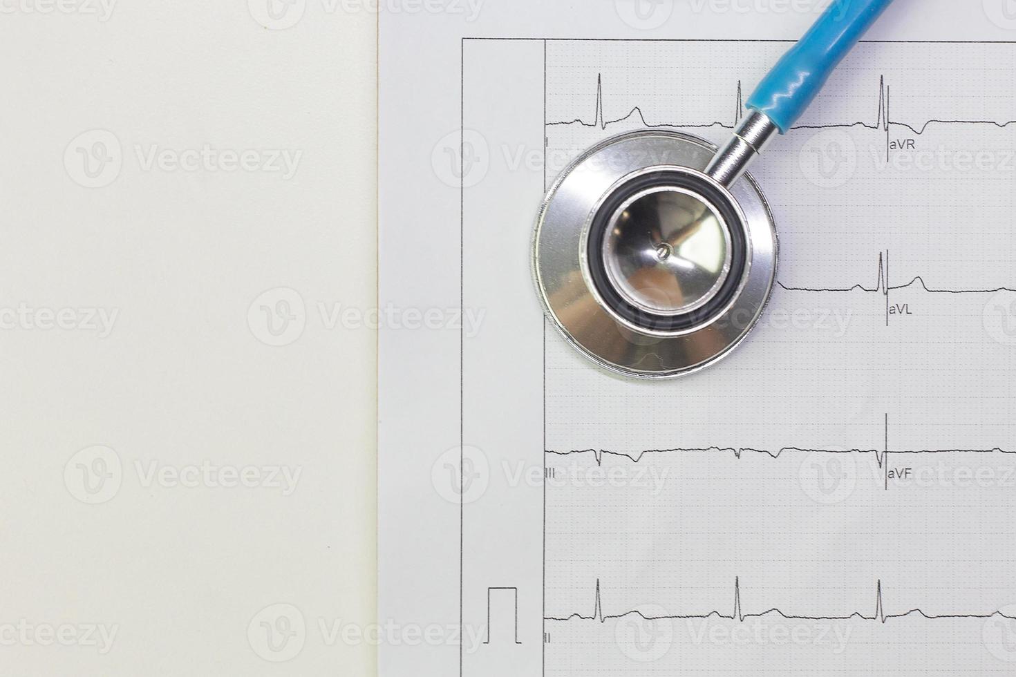 Blue stethoscopes and  Electrocardiography  chart close up image. photo